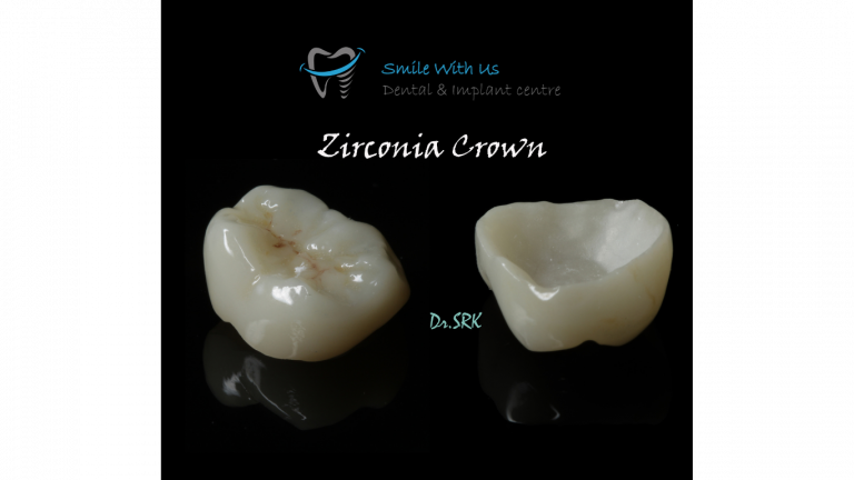 ZIRCONIA CROWN (2)