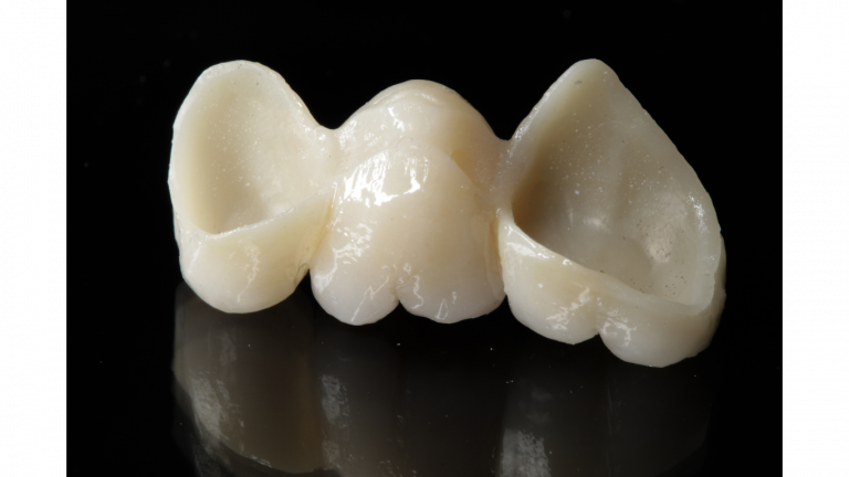 ZIRCONIA CROWN (3)