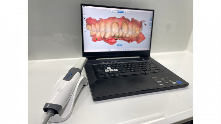 intra oral scanner (1)