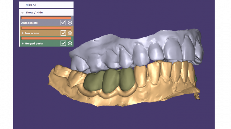 intra oral scanner (5)