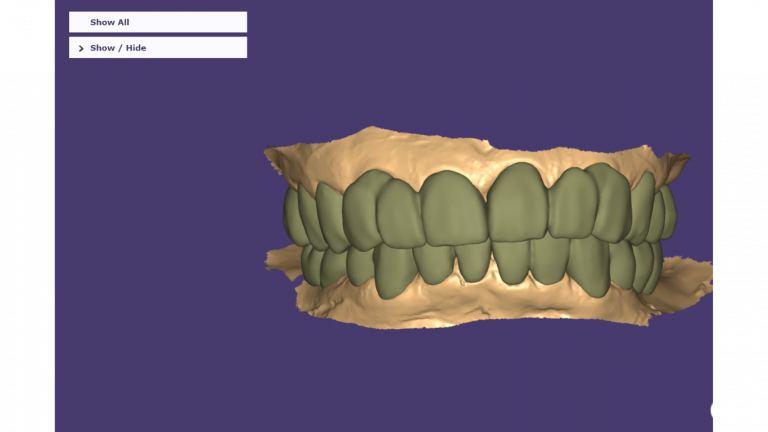 intra oral scanner (6)