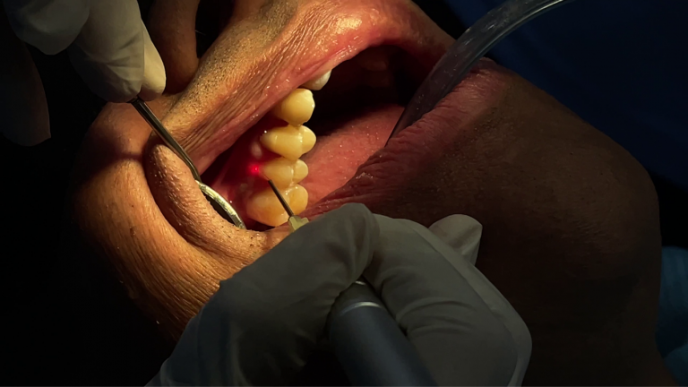 laser dentistry (1)